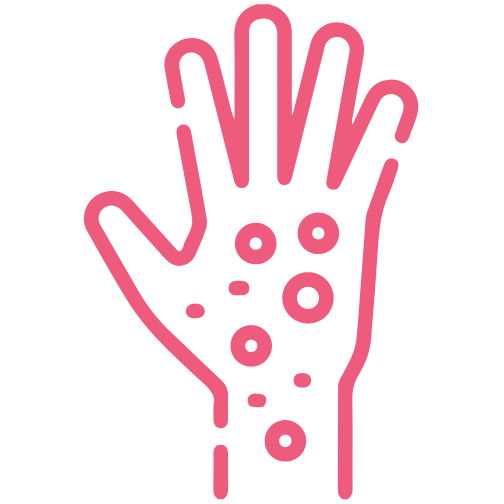 Skin Allergies and Eczema