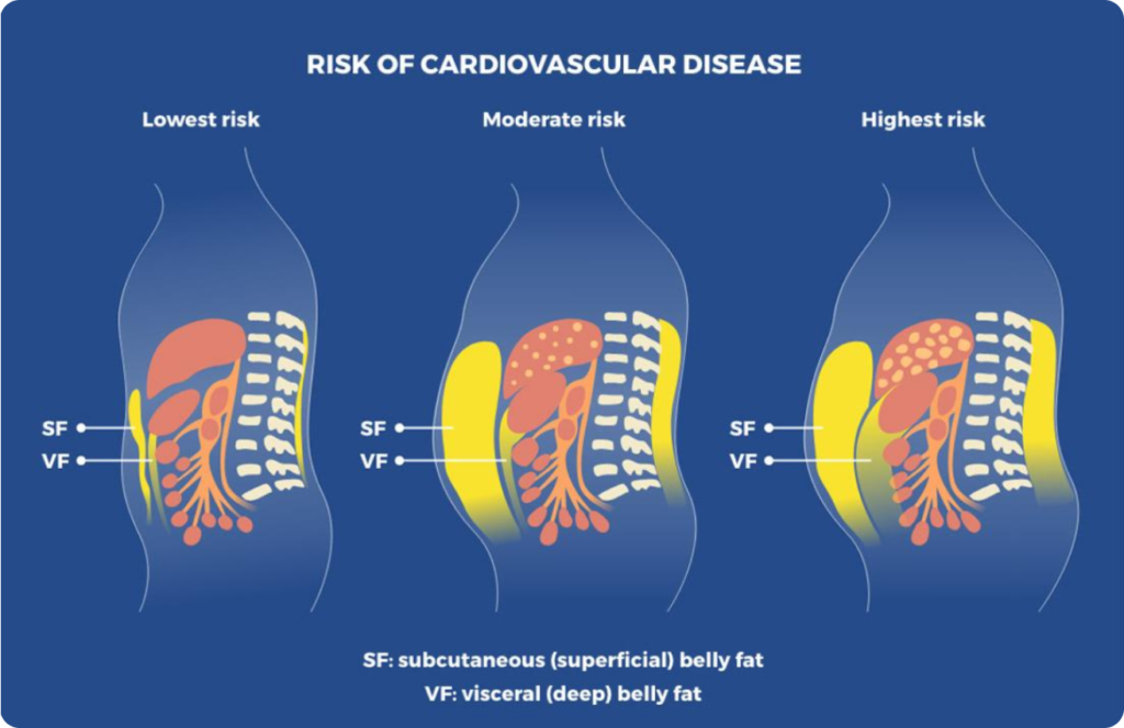 VISCERAL FAT: THE “HIDDEN FAT”​